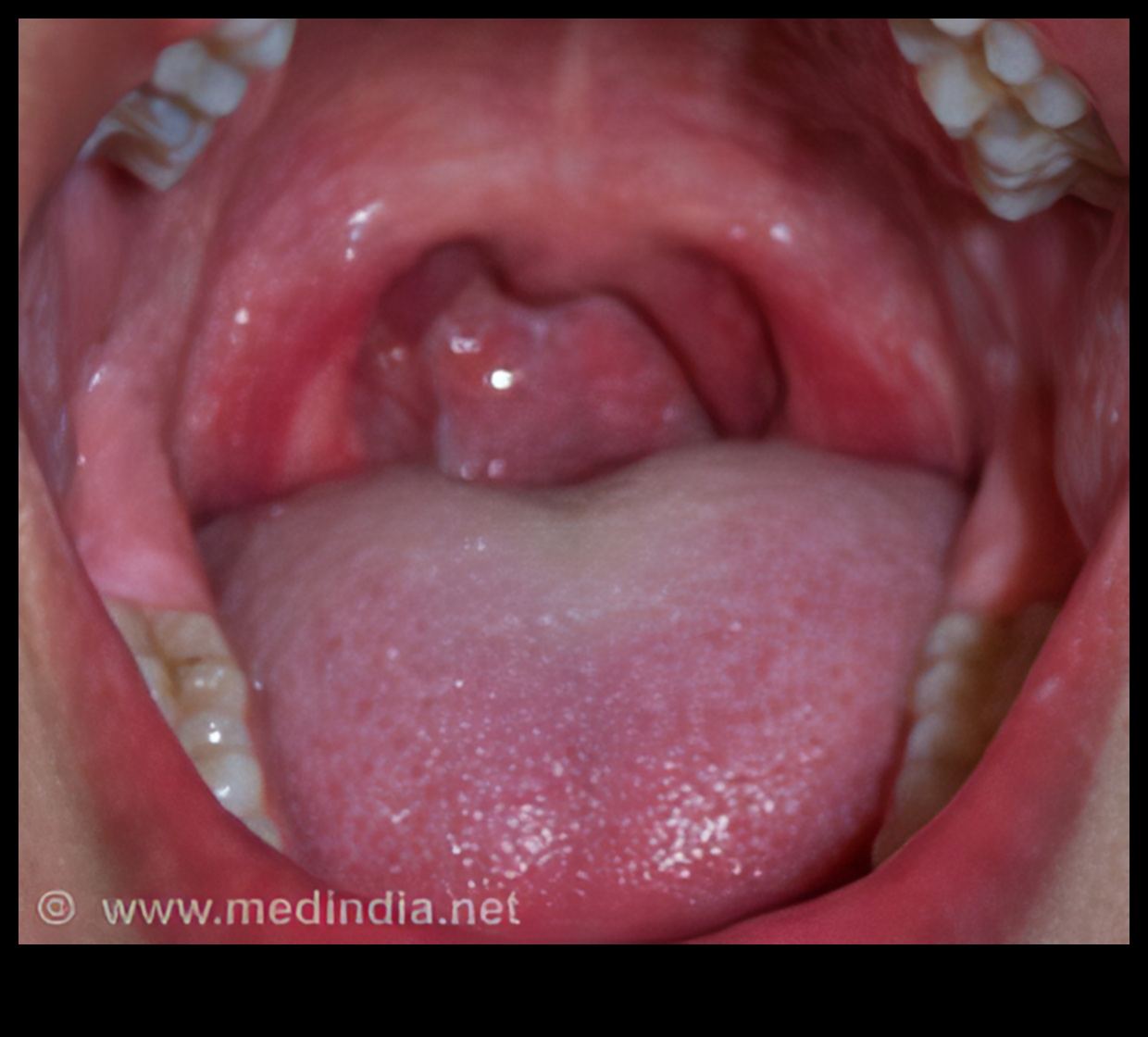 Tiny Taste Buds, Big Potential: Pediatric Nutrition Mastery